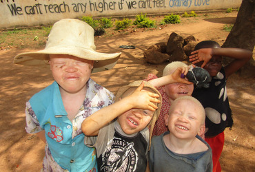 Albinokinderen in Tanzania hebben uw hulp nodig