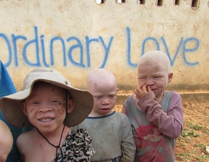 Albinokinderen